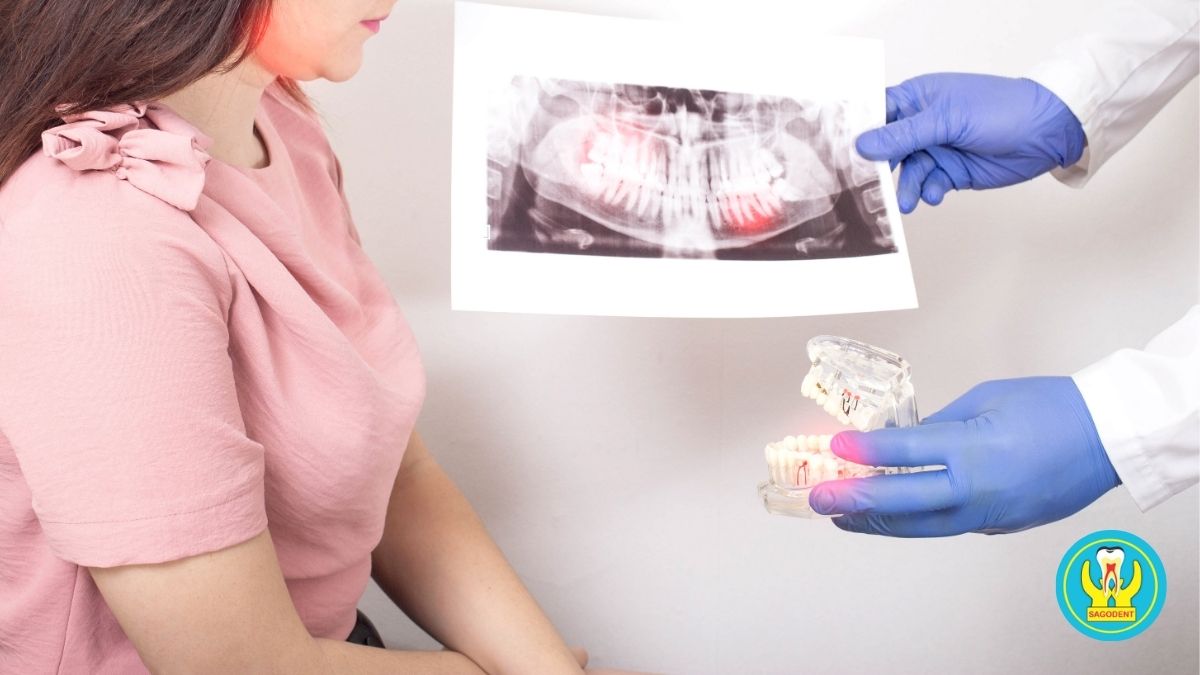 Điều trị viêm tủy răng bằng phương pháp nội nha tại phòng khám nha khoa