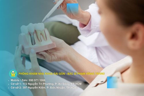 Hướng dẫn chăm sóc implant cho người lớn tuổi sau khi trồng răng để kéo dài tuổi thọ