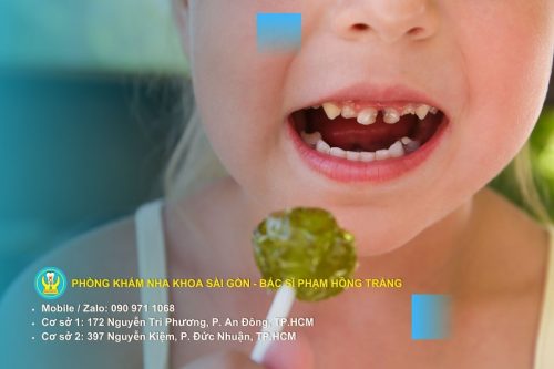 Răng hư tổn nặng với biểu hiện ê buốt và đổi màu