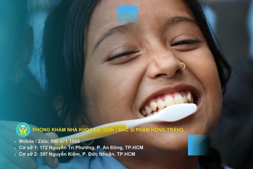 Răng thừa và những nguy cơ tiềm ẩn
