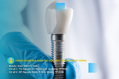 Rủi ro cấy ghép implant hình ảnh mô mềm và xương quanh trụ Implant bị viêm quanh Implant