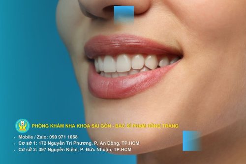 So sánh hàm duy trì cố định với các loại hàm khác