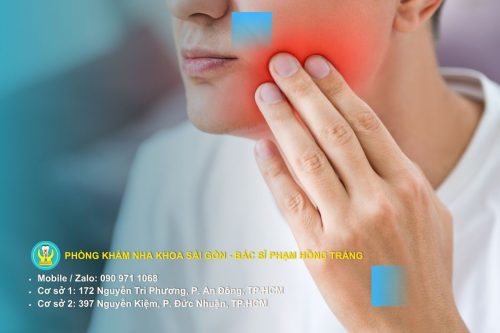Cách giảm đau nhức chân răng tạm thời tại nhà bằng nước muối ấm