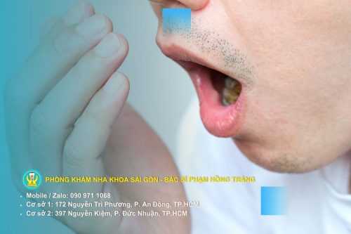 Điều trị hơi thở có mùi là ưu tiên để tránh mất thiện cảm với người đối diện