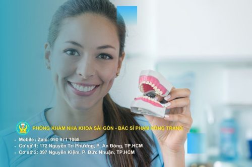 Mắc cài kim loại thường và mắc cài sứ tự buộc: lựa chọn theo ngân sách và thẩm mỹ