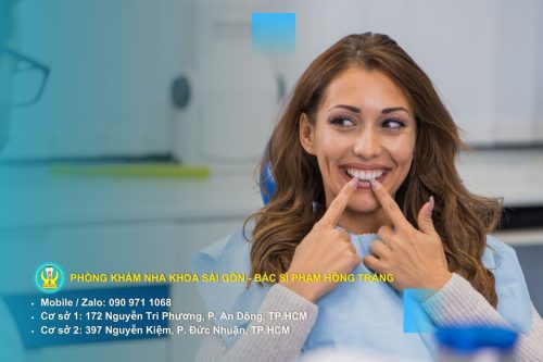 Mắc cài thường và mắc cài tự buộc: so sánh cấu tạo chun buộc và chốt tự đóng