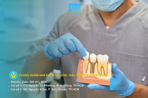 Trồng răng Implant giúp phục hồi răng mất và ngăn ngừa tiêu xương hàm hiệu quả