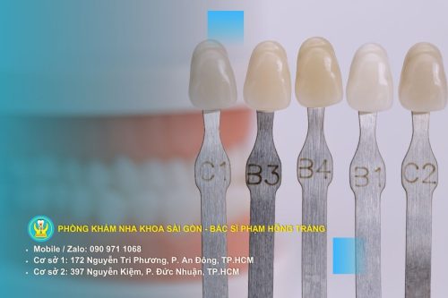Hình ảnh so sánh các cấp độ răng xỉn màu theo thang VITA Shade Guide