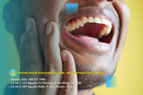 Nướu bị viêm nha chu, tổn thương nặng do hút thuốc lá lâu ngày