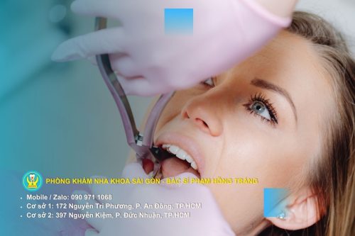 Súc miệng bằng nước muối ấm giúp giảm chảy máu chân răng tại nhà