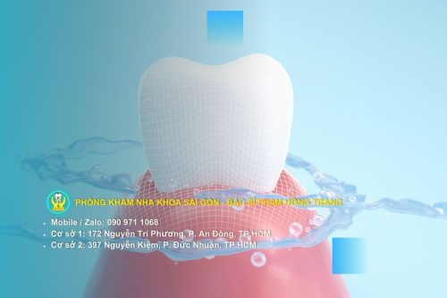 Dấu Hiệu Răng Xỉn Đen Cần Đi Khám Ngay