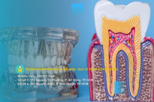 Dấu hiệu nhận biết ê buốt răng