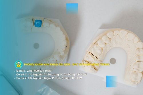 Dấu hiệu nhận biết răng khoẻ mạnh