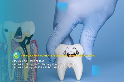 Ê buốt răng là gì