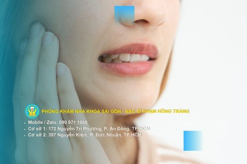 Răng sâu độ 1 là gì