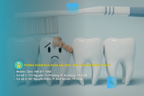 Hiểu về cơ chế tác động của thực phẩm lên men răng