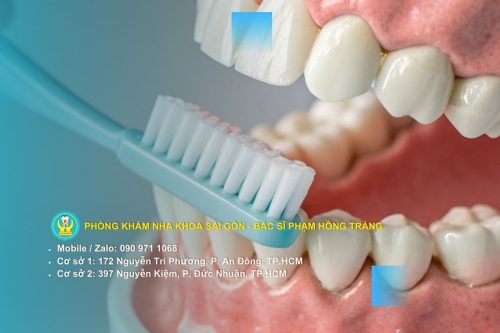 Những cảnh báo tức thì khi lười đánh răng