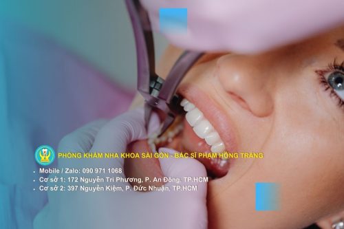 Những dấu hiệu cảnh báo cần phải thực hiện nhổ răng khôn ngay