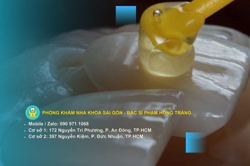 Răng sứ khi về già có đảm bảo độ bền và an toàn hay không