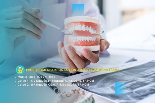 Số lượng răng khôn cần nhổ phụ thuộc vào yếu tố nào