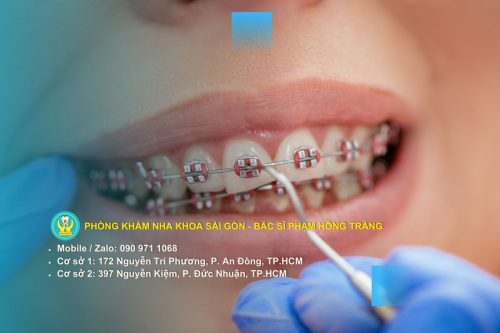 Sự chuyển dịch từ nha khoa phản ứng sang nha khoa dự báo