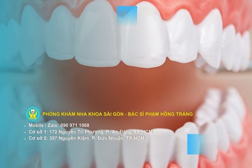 Tầm quan trọng chiến lược của răng sữa đối với trẻ em