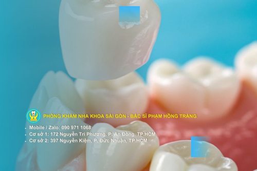 Tình trạng răng miệng đặc thù ở người cao tuổi ảnh hưởng đến việc bọc sứ