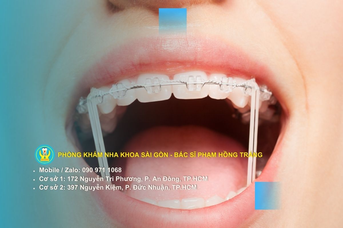Vệ sinh và chăm sóc răng miệng chuyên sâu tại nhà