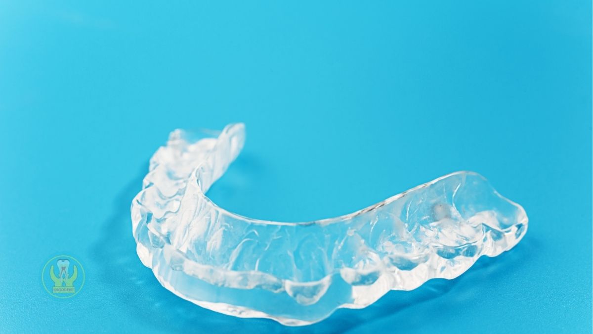 Những câu hỏi thường gặp khi chọn nơi mua máng chống nghiến răng