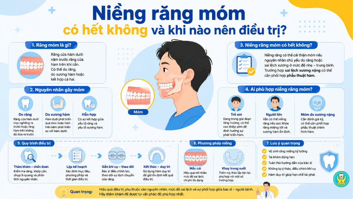 Niềng răng móm có hết không và khi nào nên điều trị