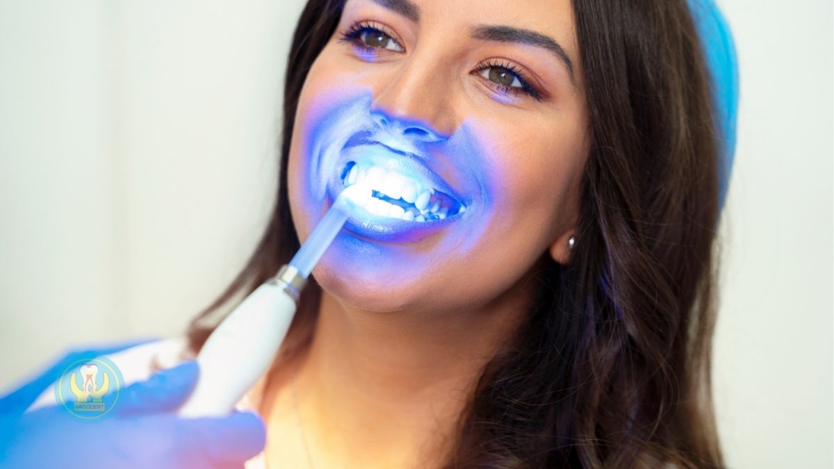 Review các loại bột trắng răng phổ biến nhất hiện nay