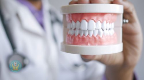 Các loại máng nghiến răng từ nhựa mềm đến máng chuyên sâu