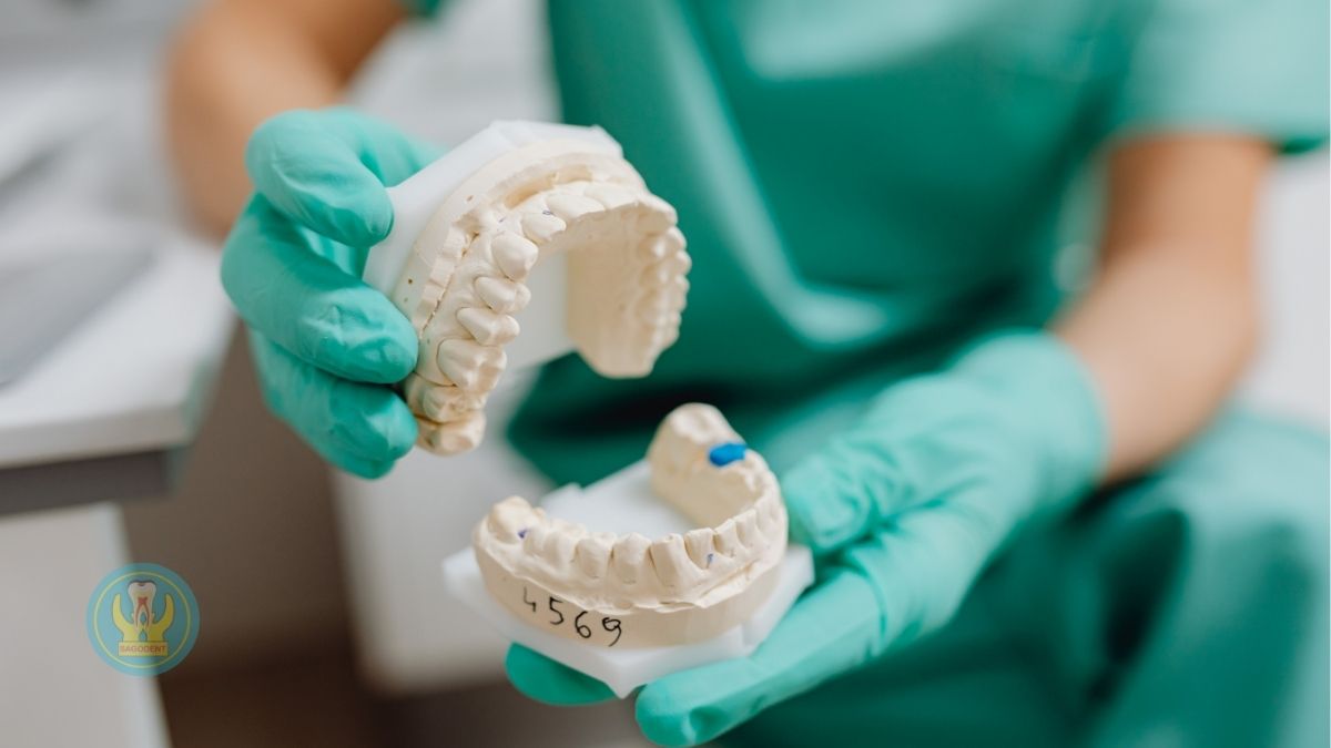 Răng sứ Zirconia là gì