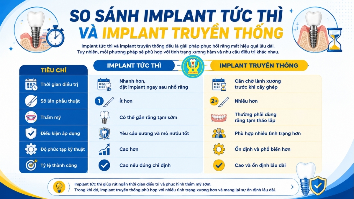 So sánh implant tức thì và implant truyền thống trong phục hình răng mất