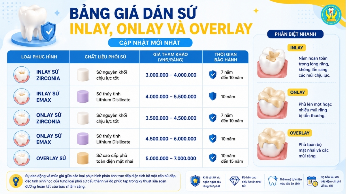 Bảng giá dán sứ Inlay, Onlay và Overlay mới