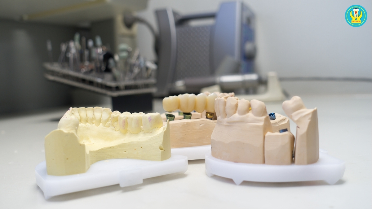 Các dòng răng sứ Zirconia phổ biến theo xuất xứ