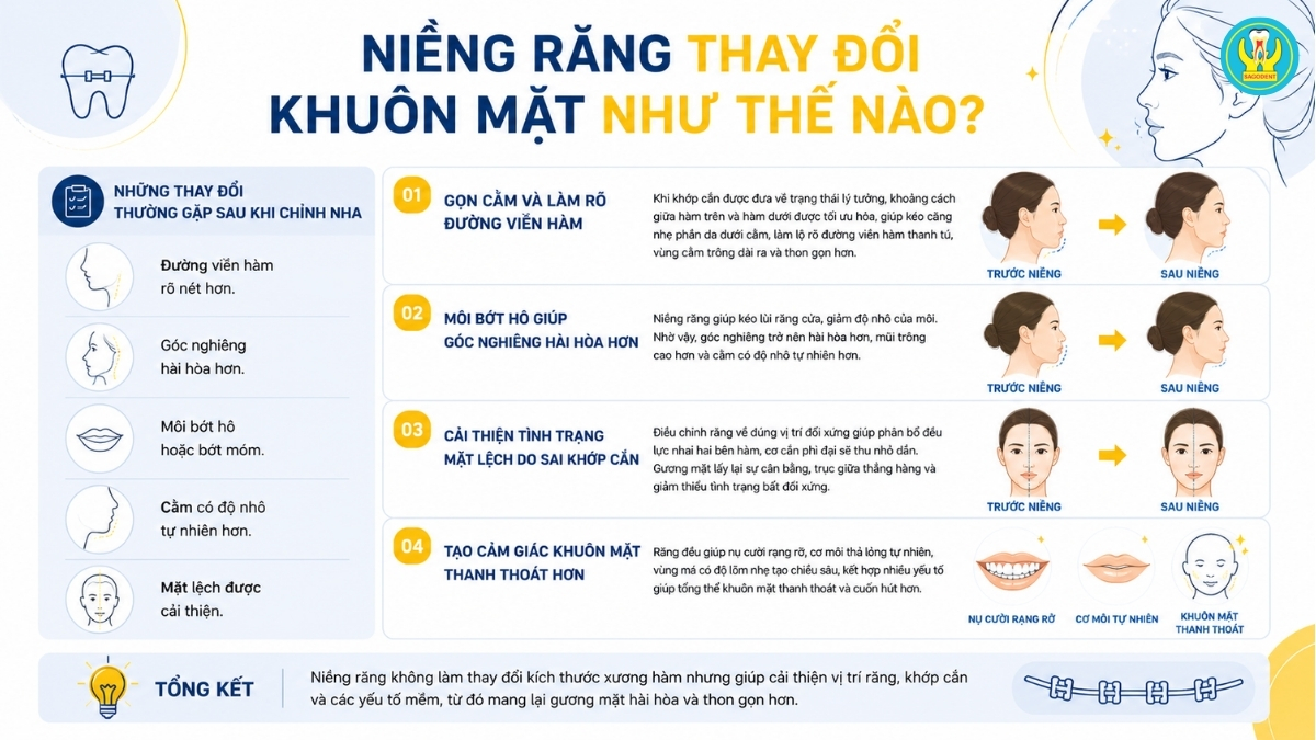 Niềng răng thay đổi khuôn mặt như thế nào