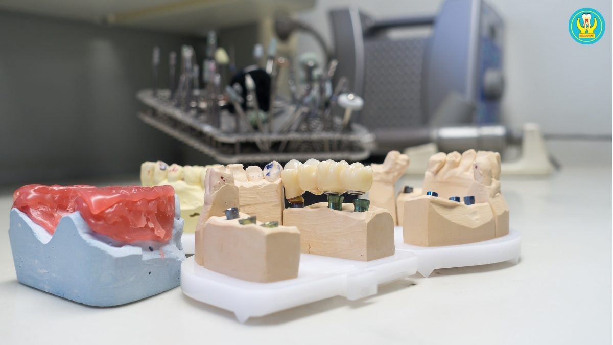 Răng sứ Zirconia là gì