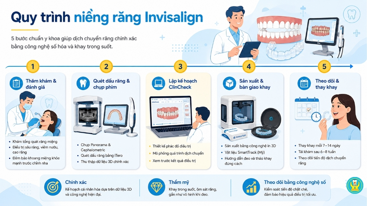 Quy trình niềng răng Invisalign