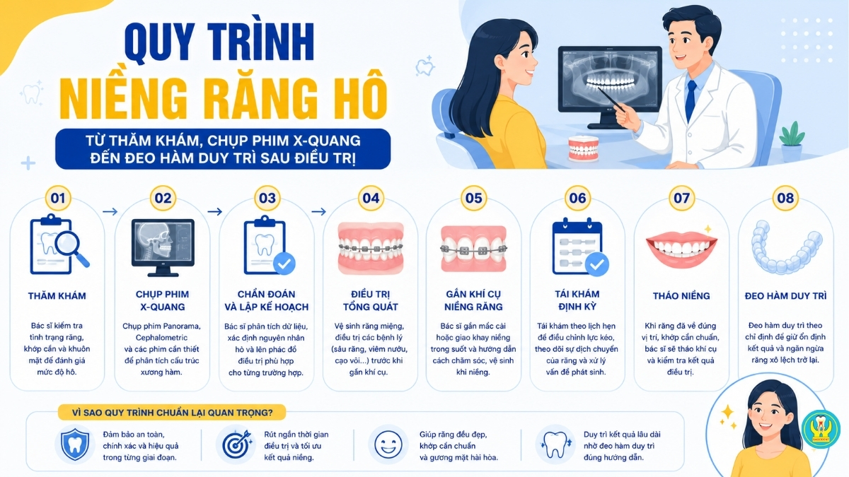 Quy trình niềng răng hô từ thăm khám, chụp phim X-quang đến đeo hàm duy trì sau điều trị