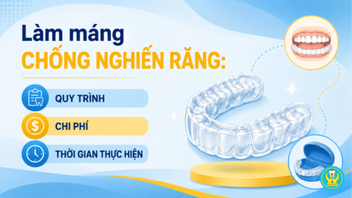Làm máng chống nghiến răng: Quy trình, chi phí và thời gian thực hiện