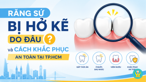 Răng sứ bị hở kẽ do đâu và cách khắc phục an toàn tại TP.HCM