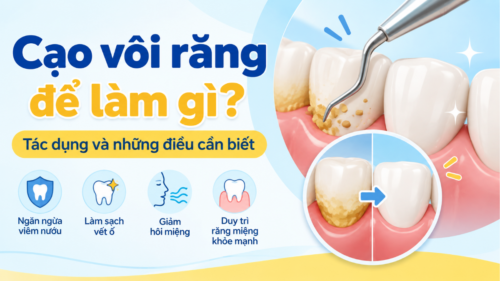 Cạo vôi răng để làm gì
