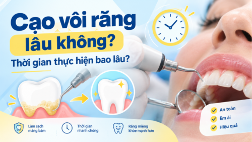 Cạo vôi răng lâu không