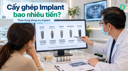 Cấy ghép Implant bao nhiêu tiền theo từng dòng trụ Implant
