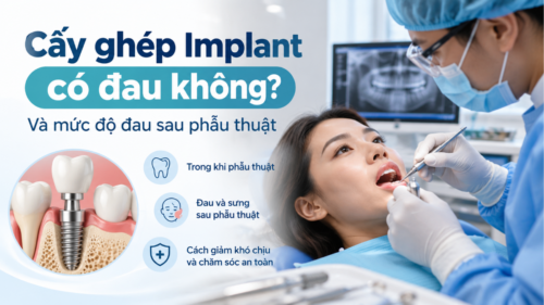 Cấy ghép implant có đau không và mức độ đau sau phẫu thuật