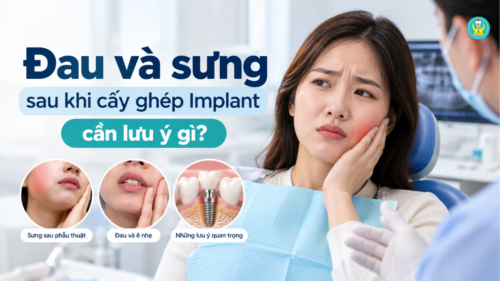 Đau và sưng sau khi cấy ghép implant cần lưu ý gì
