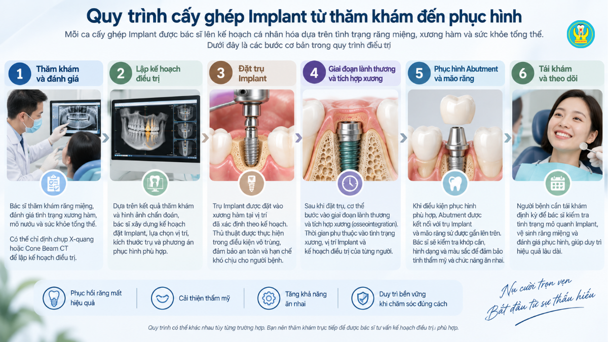 Quy trình cấy ghép Implant từ thăm khám đến phục hình