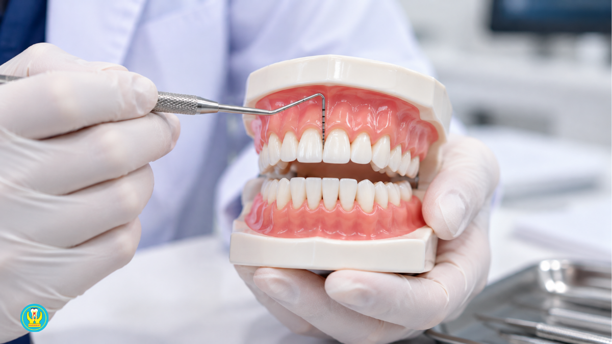 Cười hở lợi là gì và cách chữa theo từng nguyên nhân